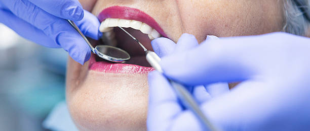 Best Chipped Tooth Repair Near Me  in Franklin Park, NJ